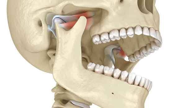 Illustration of human skull, with TMJs highlighted